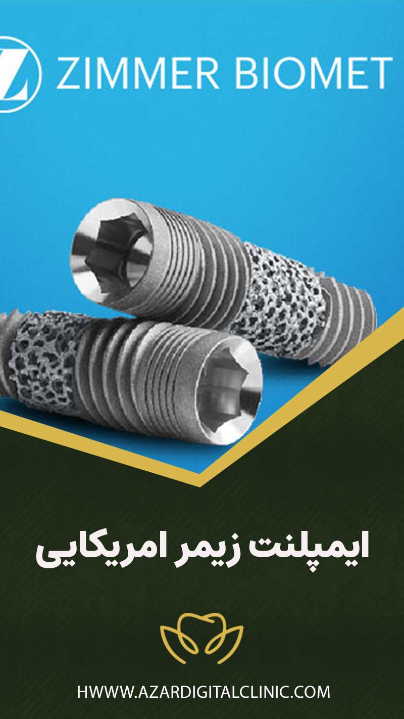 ایمپلنت زیمر امریکایی