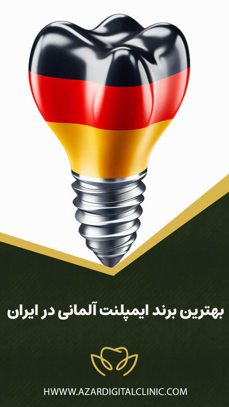 بهترین برند ایمپلنت آلمانی در ایران