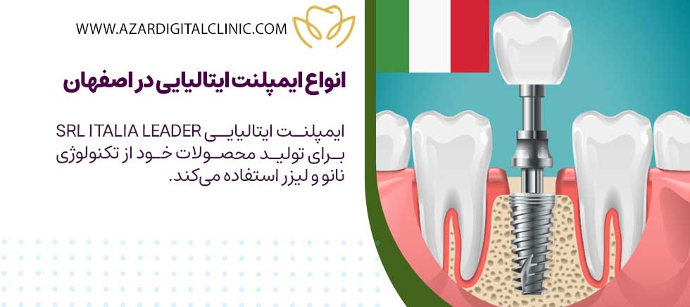 انواع ایمپلنت ایتالیایی موجود در مراکز دندانپزشکی اصفهان