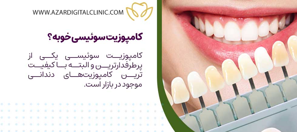 کامپوزیت سوئیسی خوبه؟
