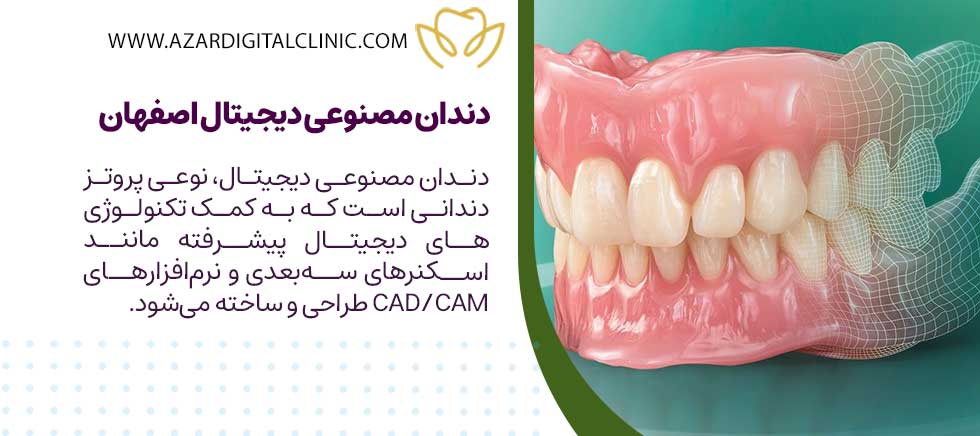 دندان مصنوعی دیجیتال اصفهان