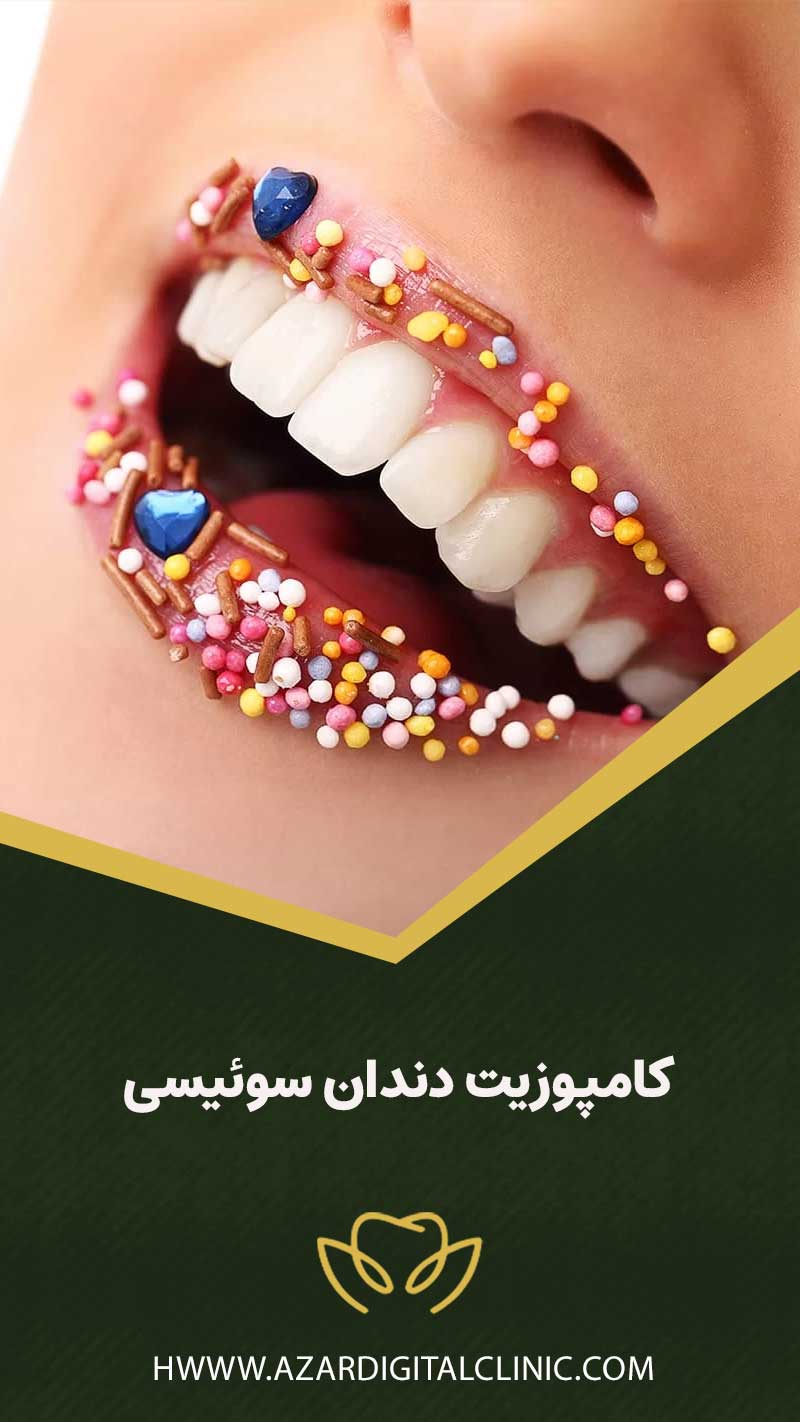کامپوزیت دندان سوئیسی
