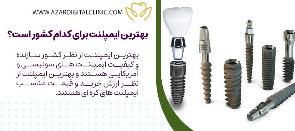 بهترین ایمپلنت برای کدام کشور است؟