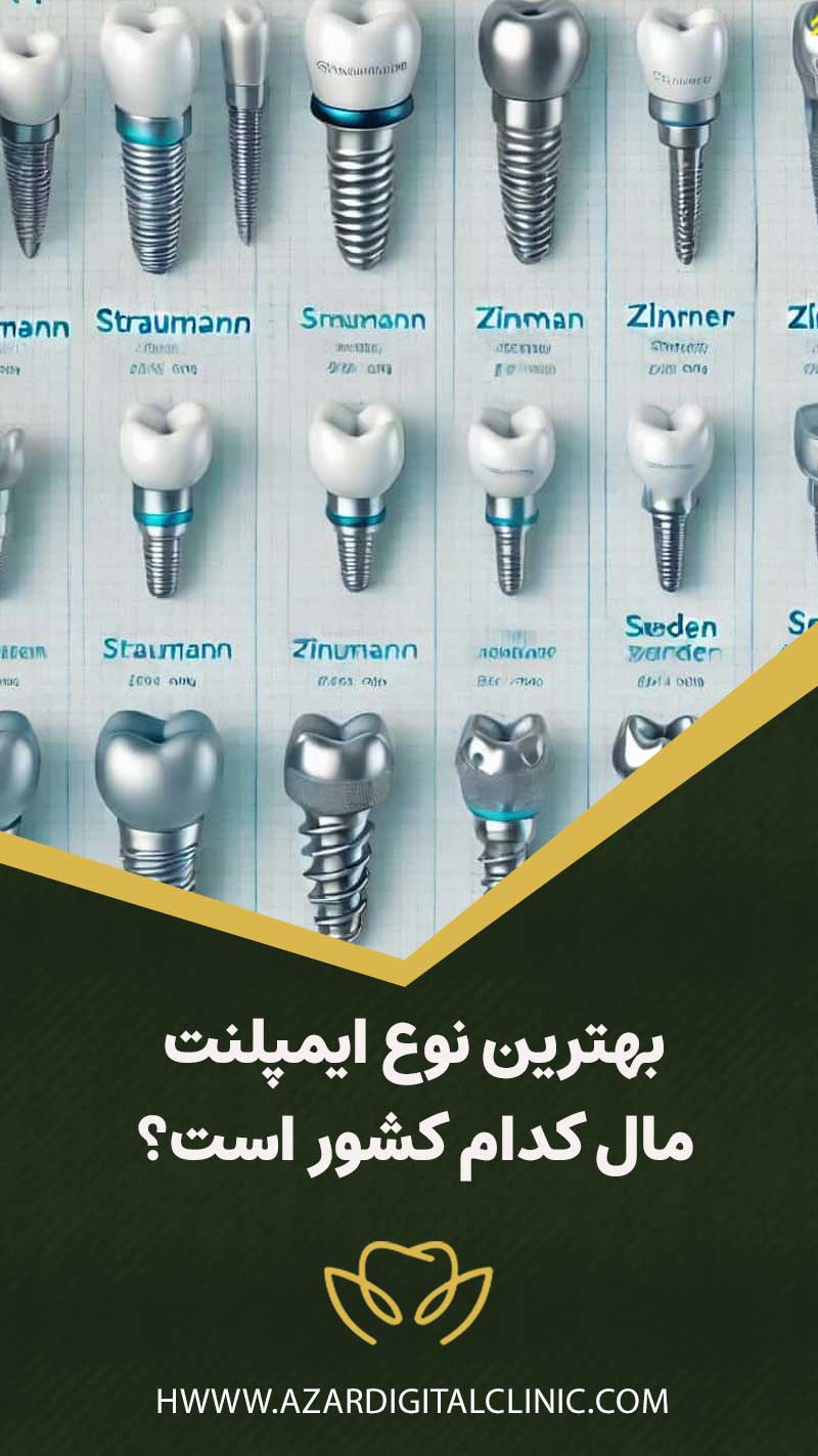 بهترین نوع ایمپلنت مال کدام کشور است؟