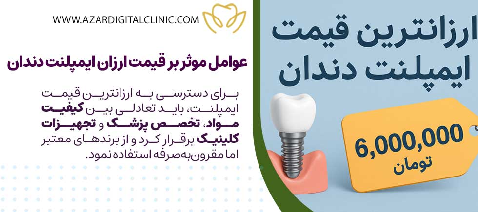 چرا بعضی مراکز ایمپلنت ارزان قیمت ارائه می‌دهند؟