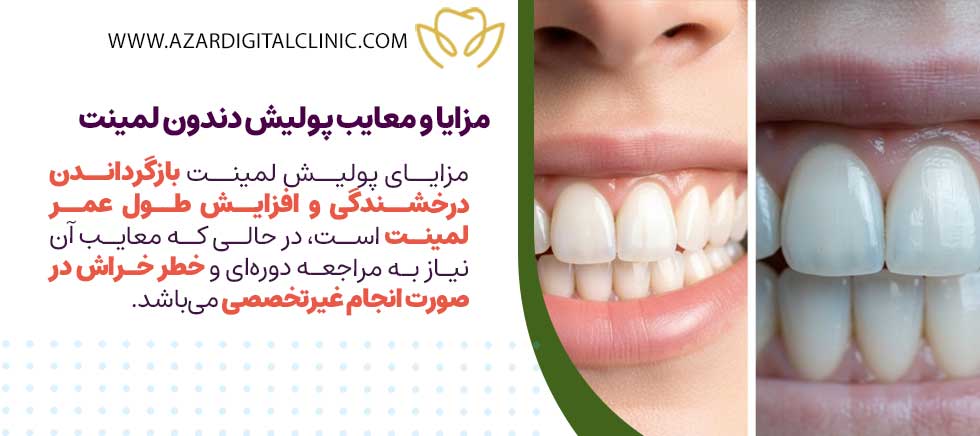 مزایا و معایب پولیش دندون لمینت