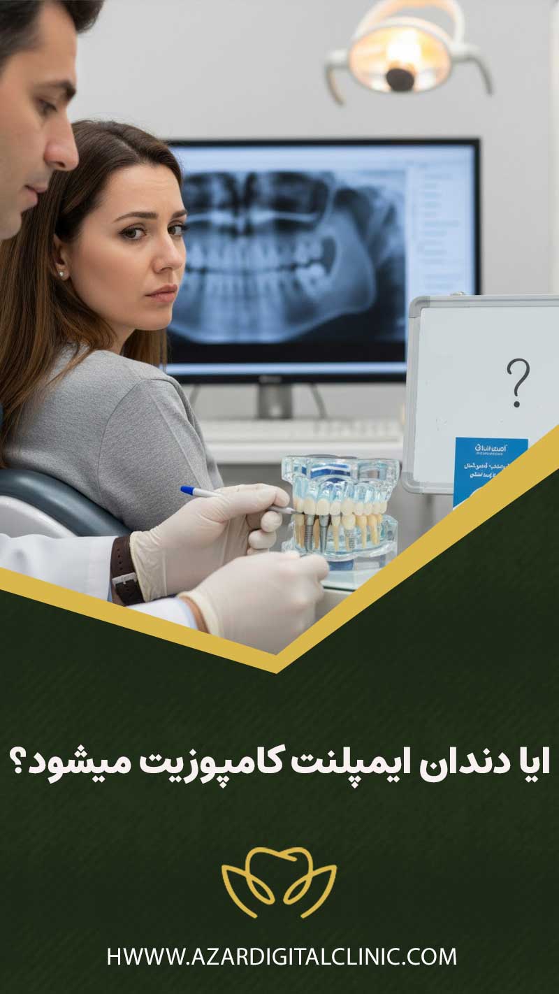 ایا دندان ایمپلنت کامپوزیت میشود؟