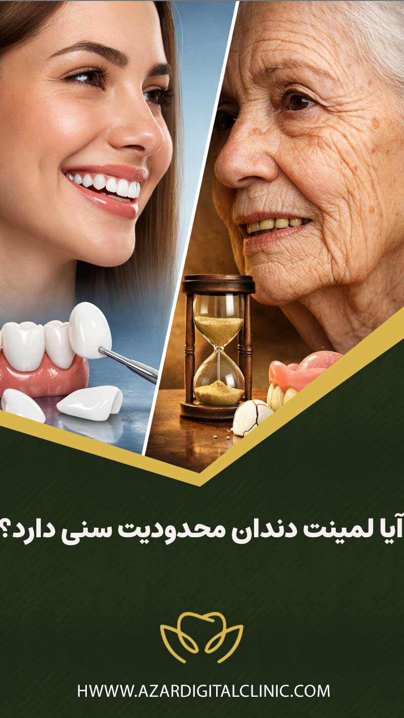 آیا لمینت دندان محدودیت سنی دارد؟