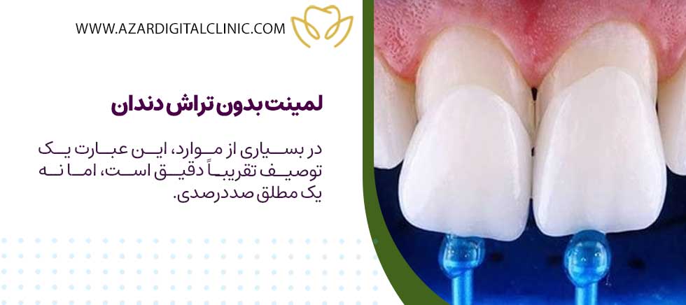 لمینت بدون تراش دندان چیست؟