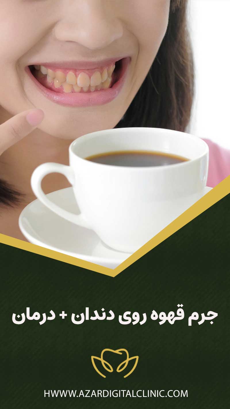 تاثیر جرم قهوه روی دندان + درمان