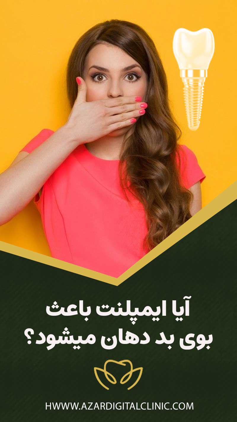 آیا ایمپلنت باعث بوی بد دهان میشود؟
