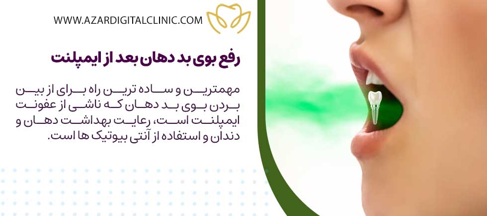 رفع بوی بد دهان بعد از ایمپلنت