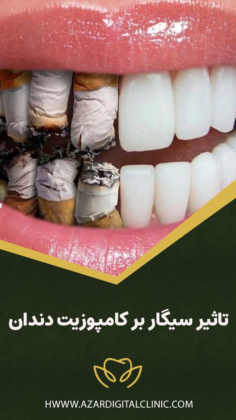 تاثیر سیگار بر کامپوزیت دندان